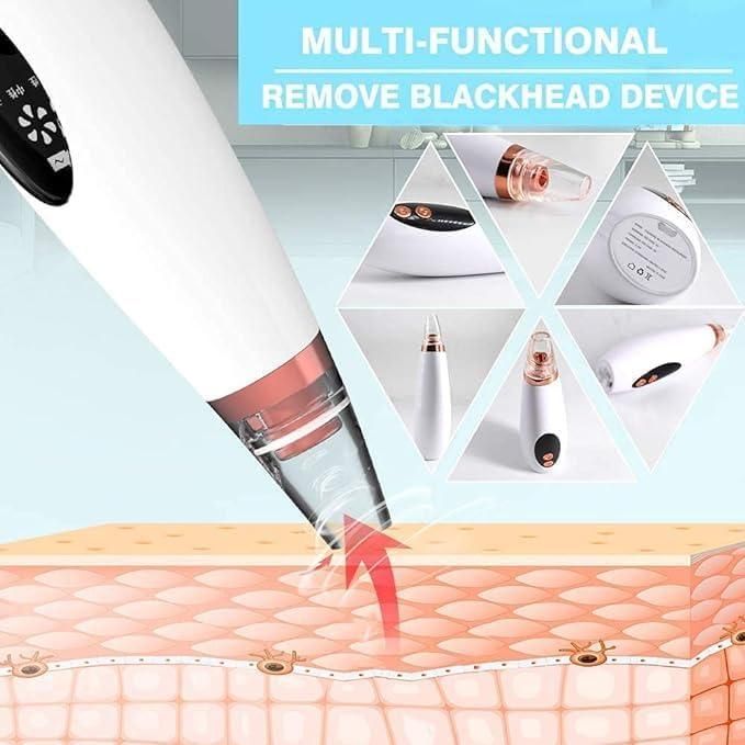 BERN 6 in 1 Multi-function Blackhead Remover Tools