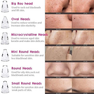 BERN 6 in 1 Multi-function Blackhead Remover Tools